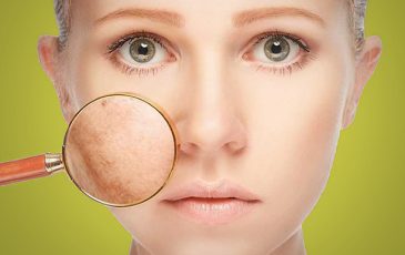 SKINBOOSTER