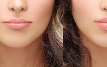 preenchimento labial